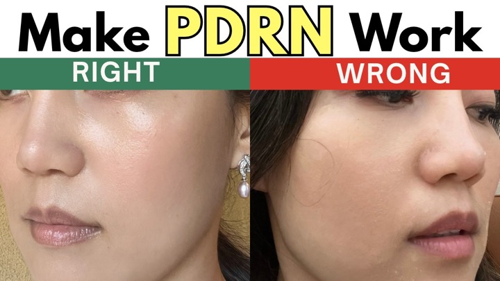 PDRN For Anti-Aging WORKS, But ONLY If You Understand This (Science Backed)