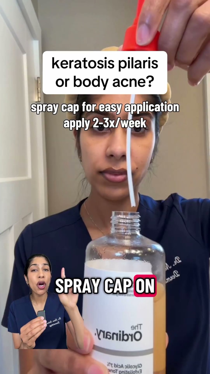 correct way to use glycolic acid #bodycare stitch with @chxrryglow