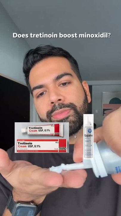 Minoxidil works great for hair loss. Some dermatologists will pair minoxidil with a retinoid like tretinoin, and people are often surprised by that! The reason is that tretinoin can increase skin cell turnover and improv