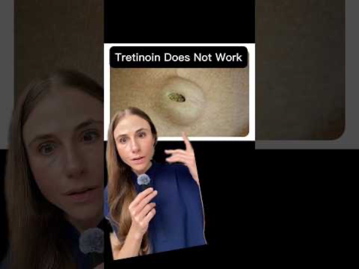 Your Tretinoin Is Doing NOTHING! 😳