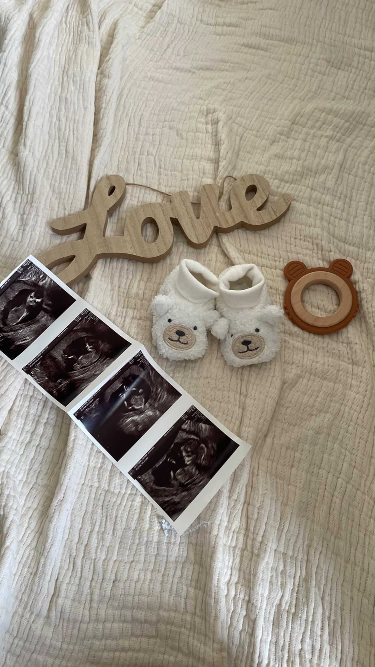 Baby A definitely has daddy’s nose 🤍 #28weeks #love 

#ultrasound #dailyreels #babyinspo #life #maternityjourney #fashiongirly