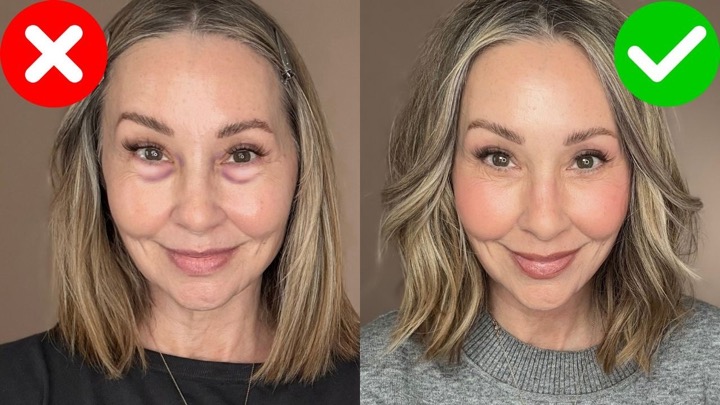 No More Dark Circles (or Bags): A Pro’s Guide for Mature Skin