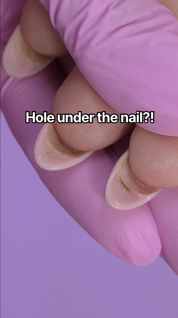 There’s a hole under her nail ?!