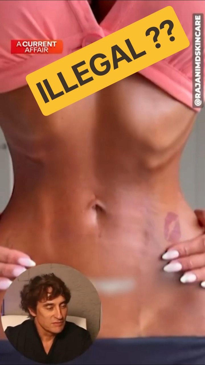 This Beauty Trend Should Be Illegal? Doctor Reacts