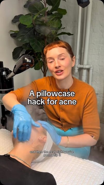 My most loved hack for clients dealing with breakouts (especially in summer!)