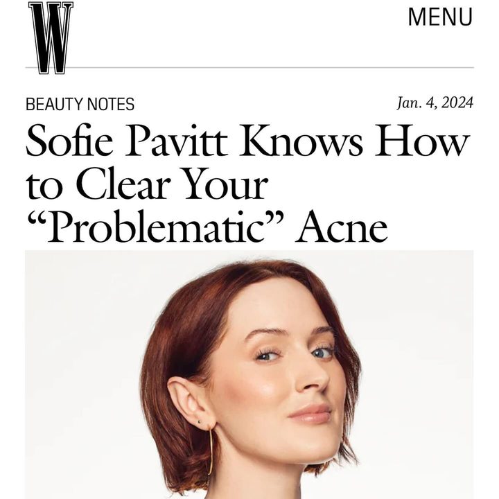 Thank you @wmag and @yseniavaldez what a dream to give you my beauty notes! including why preventative botox is a scam and how you may not NEED a 400 dollar eye cream, but you’ll absolutely love it. link in bio 💋