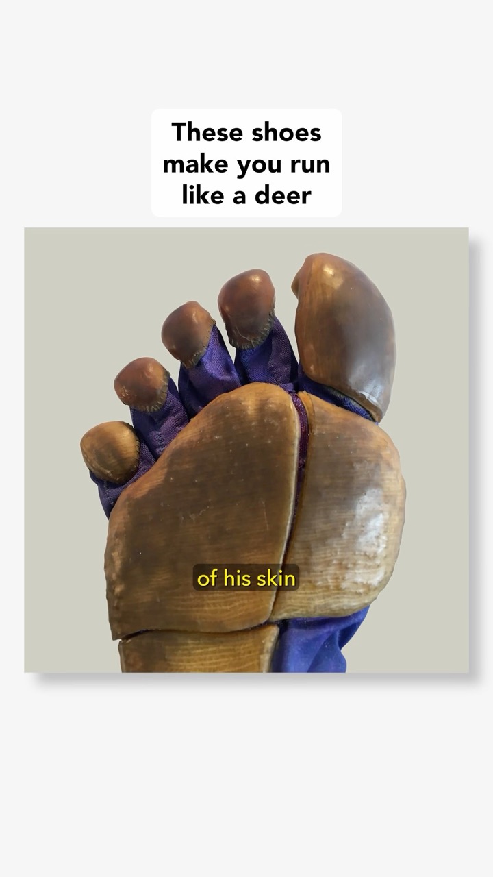 Skin shoes are coming back, baby!